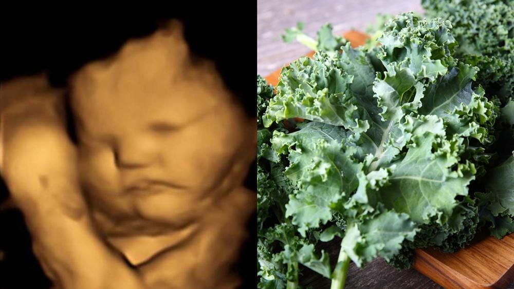 fetus kale